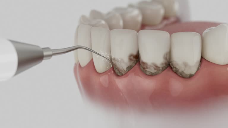Reliable Dental Implants contractor in Fairway, KS by Smile Center Dentistry